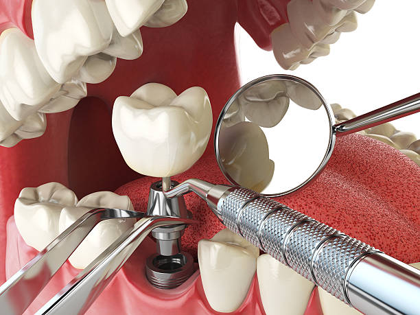 Best Emergency Treatment for Toothache in Cedar Heights, MD